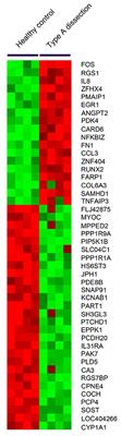 Angiopoietin 2 as a Novel Potential Biomarker for Acute Aortic Dissection